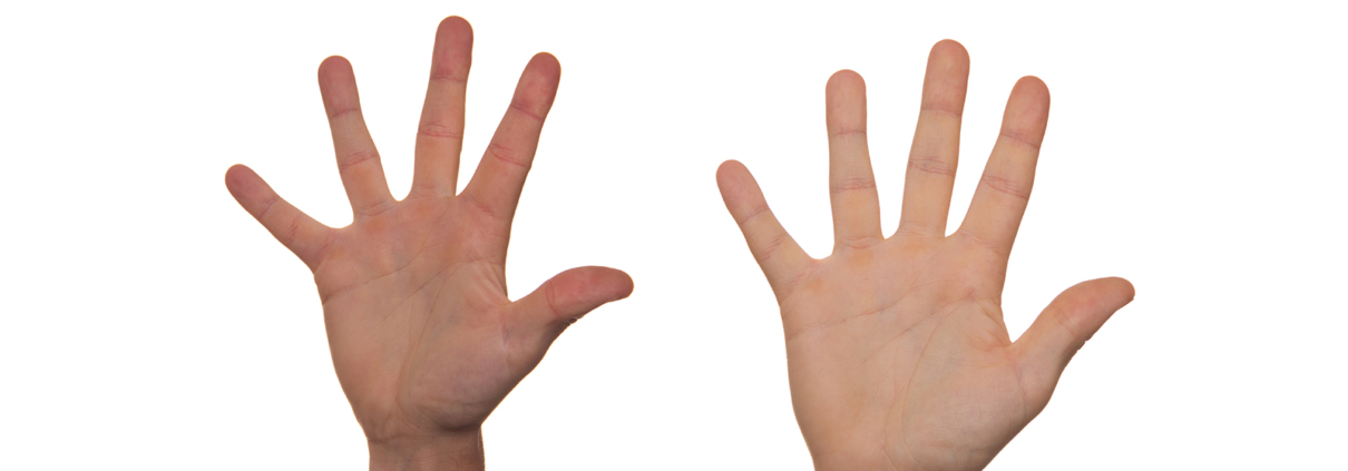Eine schwarze und eine weiße Hand mit gespreizten Fingern