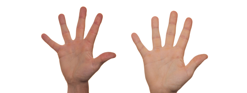 Eine schwarze und eine weiße Hand mit gespreizten Fingern
